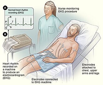 ilustrasi pemeriksaan ekg jantung