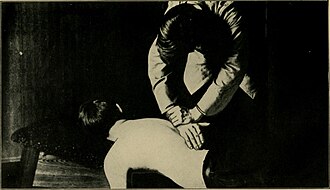 ilustrasi terapi chiropractic