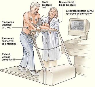 ilustrasi treadmill tes